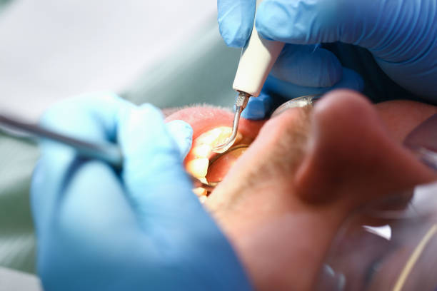 Best Root Canal Emergency Dentist  in Jeannette, PA